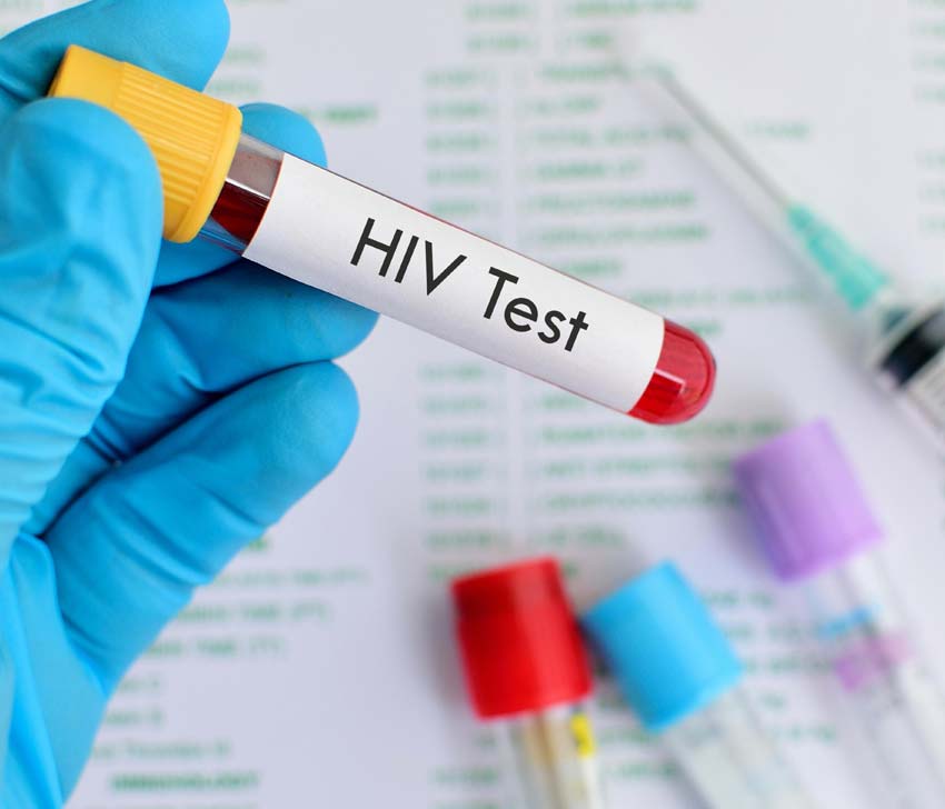 Miami-Dade Expands Free HIV Testing Services